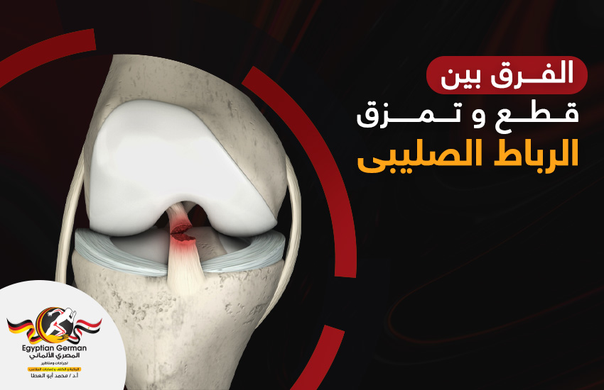 الفرق-بين-قطع-وتمزق-الرباط-الصليبي.jpg عملية تغيير مفصل الكتف