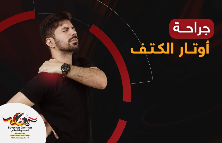 جراحة-اوتار-الكتف.webp جراحة اوتار الكتف