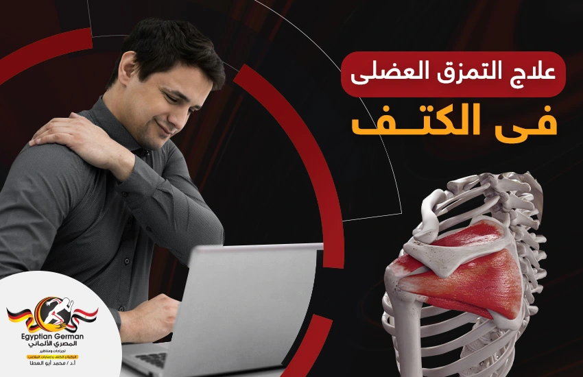 علاج التمزق العضلي في الكتف