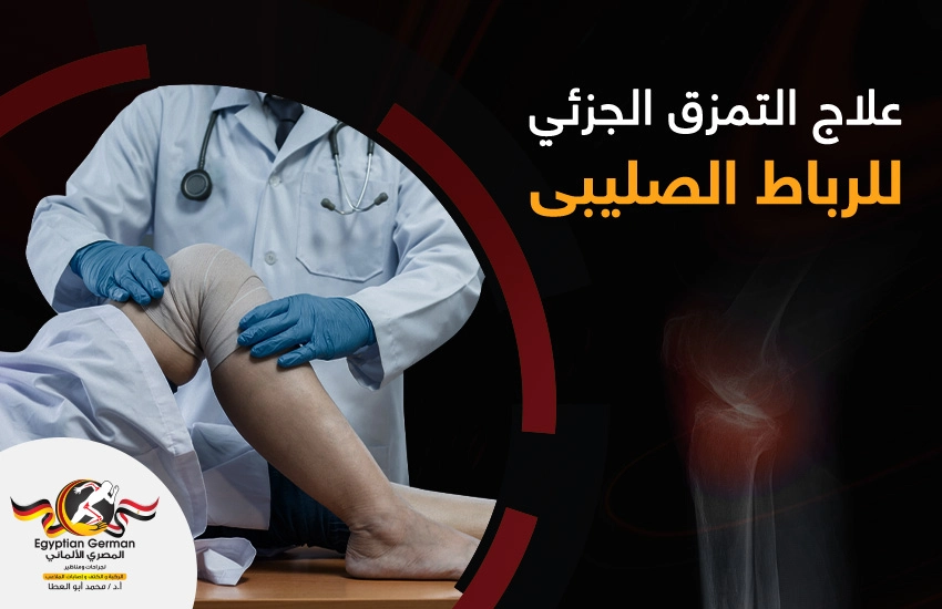 علاج-التمزق-الجزئي-للرباط-الصليبي-الامامي.webp علاج التمزق الجزئي للرباط الصليبي الامامي