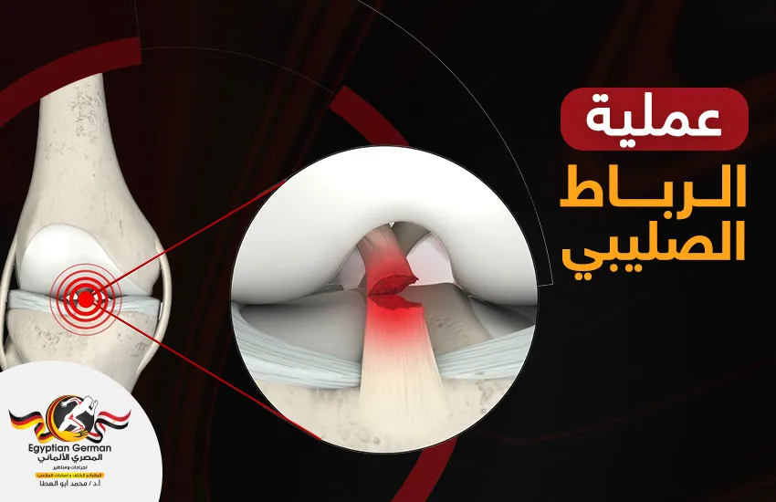 عملية رباط صليبي