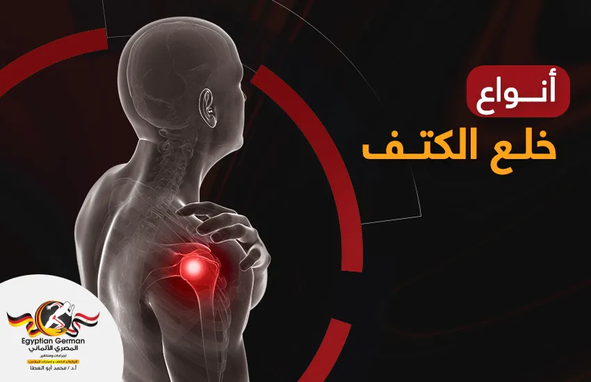 أنواع خلع الكتف وأسبابه ومضاعفاته