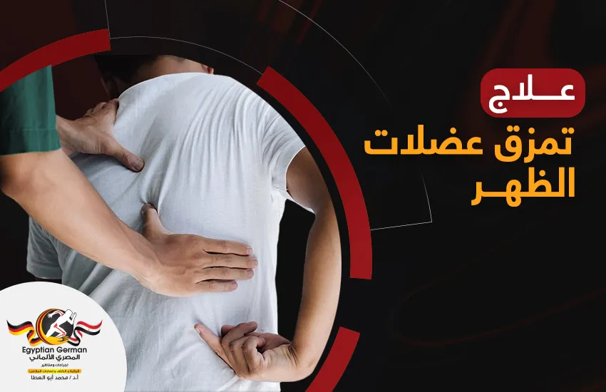 علاج تمزق عضلات الظهر