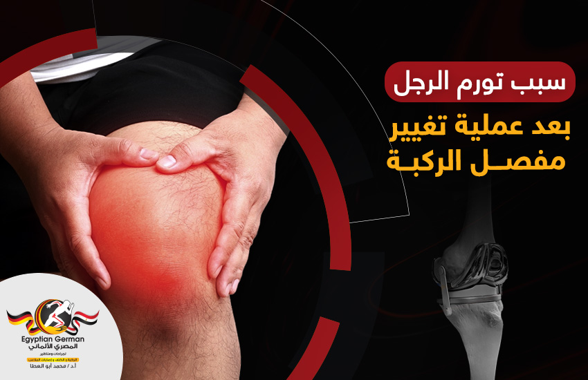 سبب تورم الرجل بعد عملية تغيير مفصل الركبة