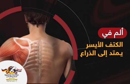 ألم في الكتف الأيسر يمتد إلى الذراع