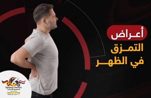اعراض التمزق في الظهر