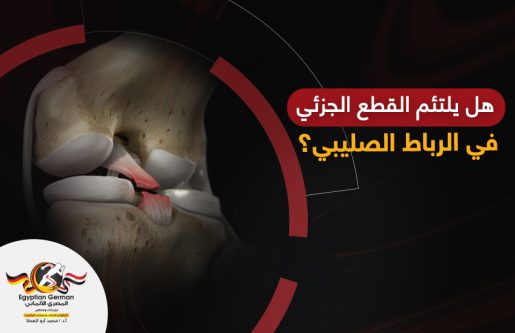 هل يلتئم القطع الجزئي في الرباط الصليبي