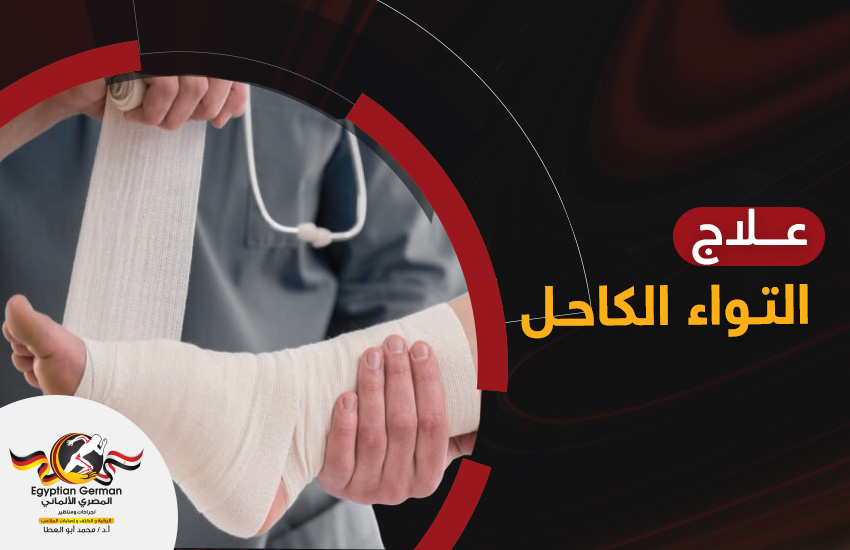 علاج التواء الكاحل بمختلف مراحله | الجراحة ليست خيارًا شائعًا
