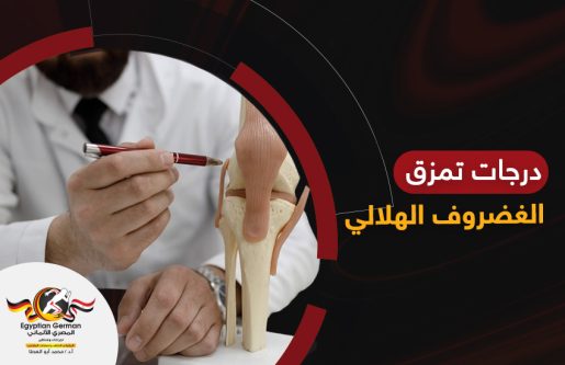 درجات تمزق الغضروف الهلالي