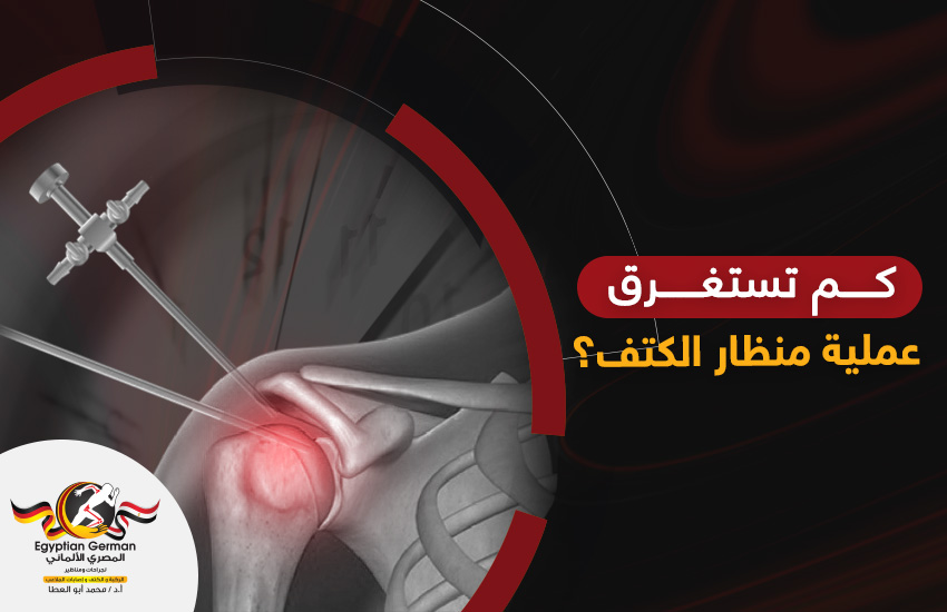 كم تستغرق عملية منظار الكتف؟ ومتى يعود الكتف طبيعي بعد العملية؟