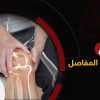 علاج التهاب المفاصل