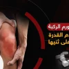 تصلب الركبة وعدم ثنيها