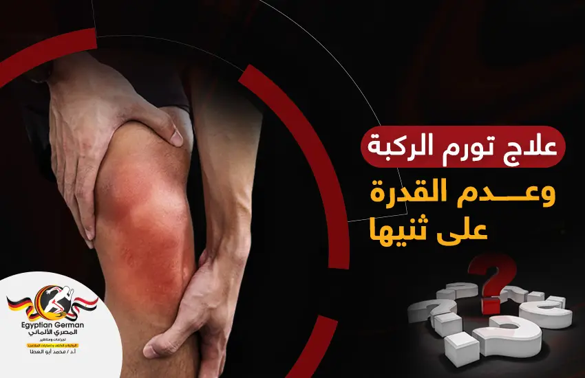 تصلب الركبة وعدم ثنيها