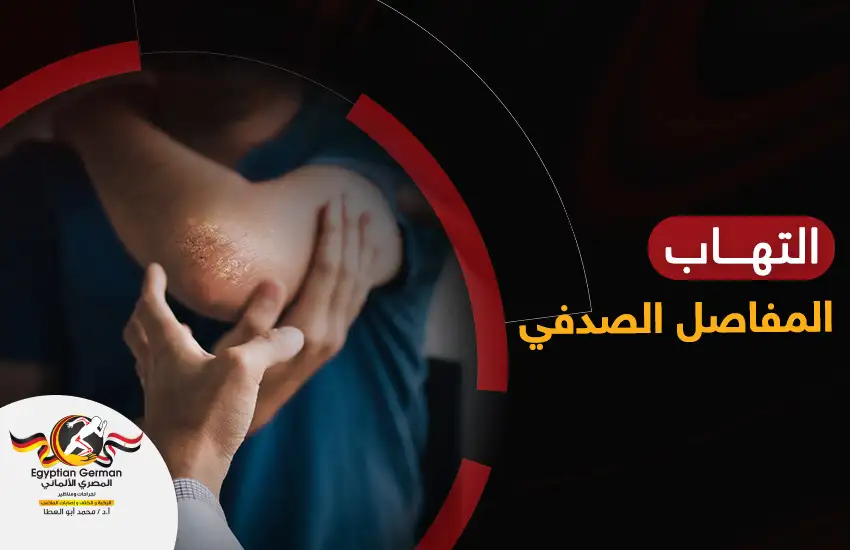 دليلك الشامل حول مرض التهاب المفاصل الصدفي