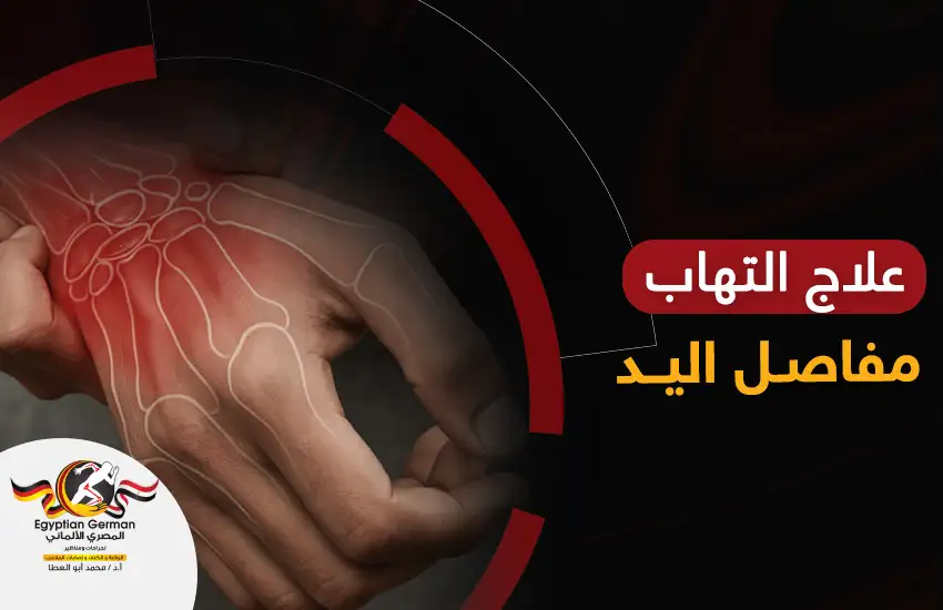 كيفية علاج التهاب مفاصل اليد