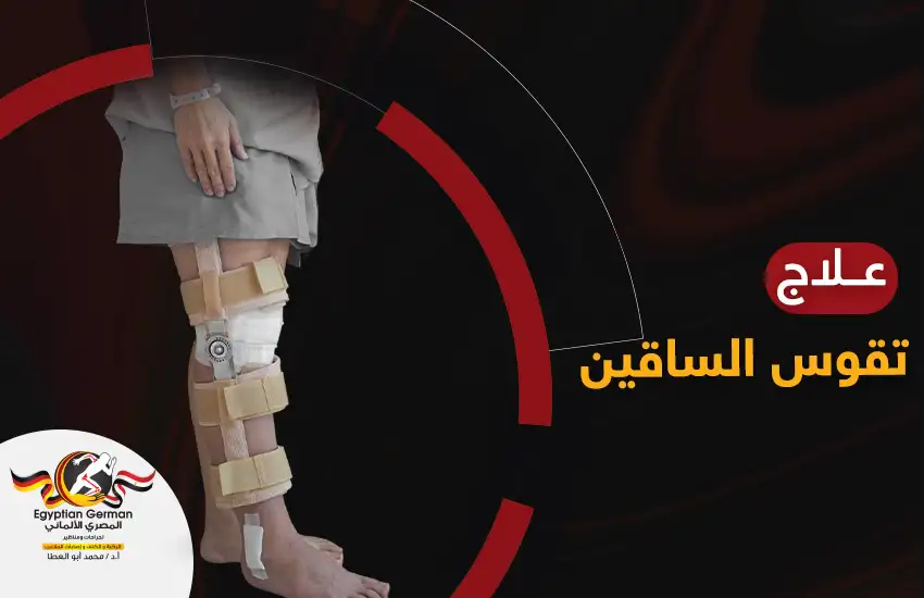 كيفية علاج تقوس الساقين