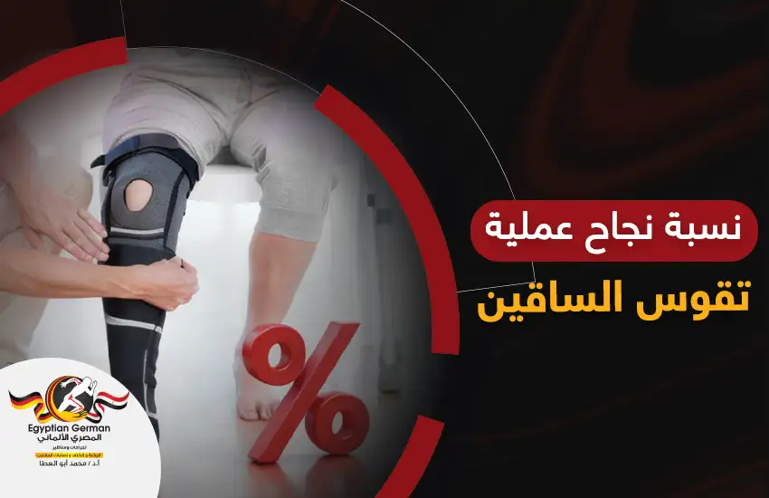 إذا رُشحت للتو للجراحة .. تعرف إلى نسبة نجاح عملية تقوس الساقين