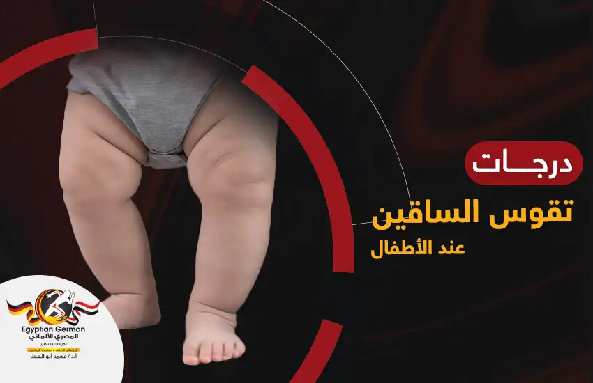 درجات تقوس الساقين عند الأطفال وكيفية تشخيصها